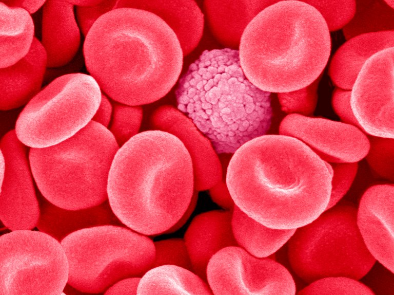 If Young Blood Can Combat Aging, It May Be Thanks to Just One Protein