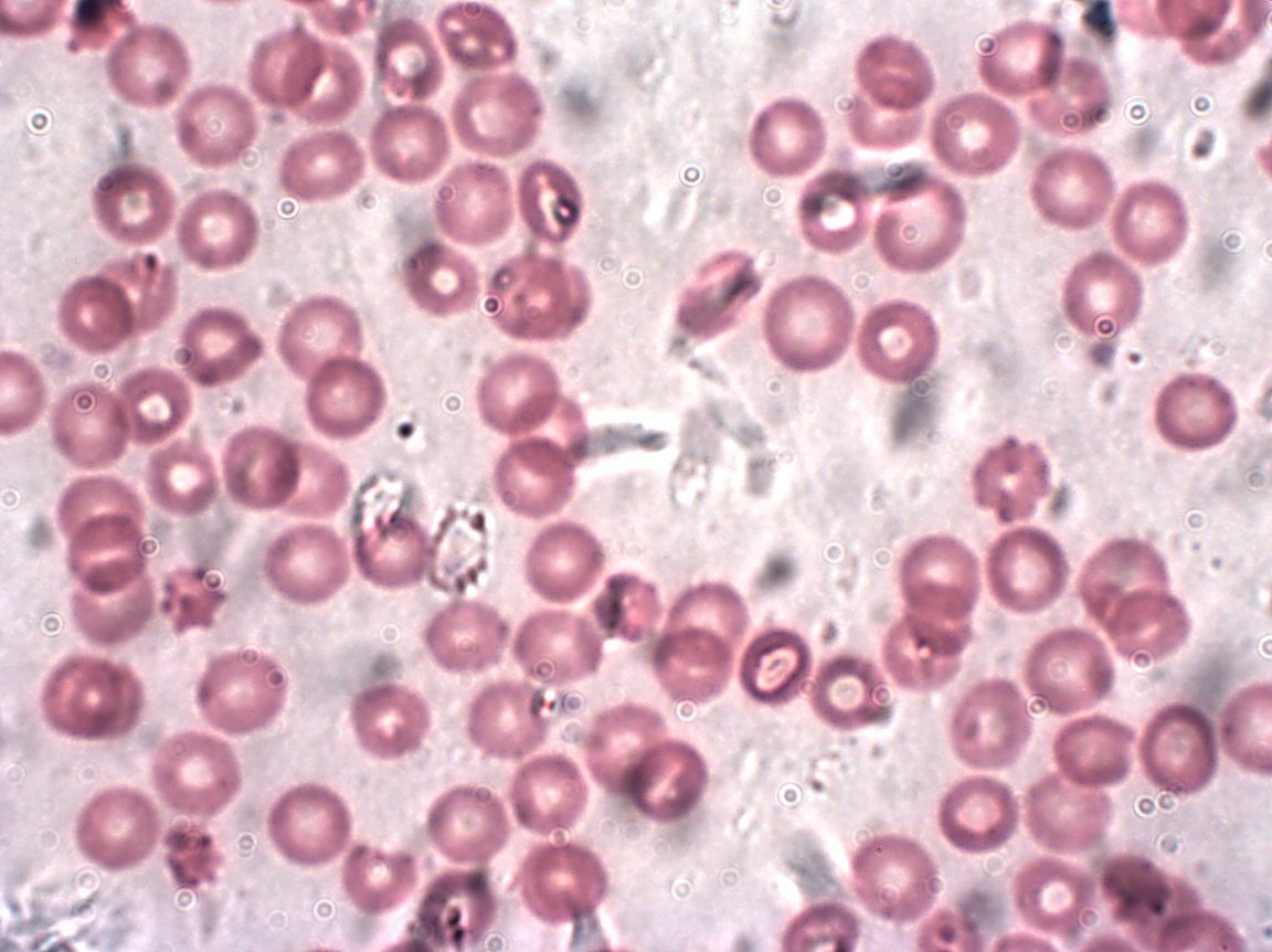 third military medical university blood test