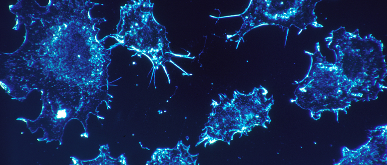 Research Shows That 40% of Cancers Are Entirely Preventable