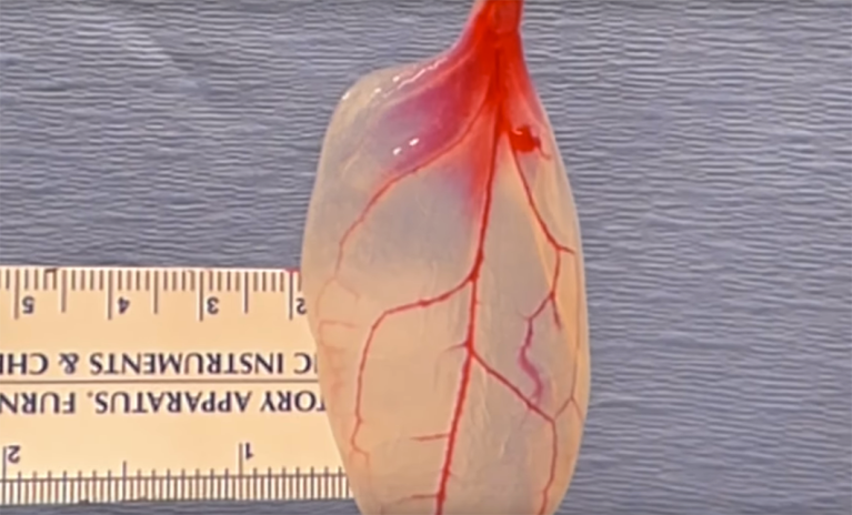 Researchers Have Transformed a Spinach Leaf Into Working Heart Tissue