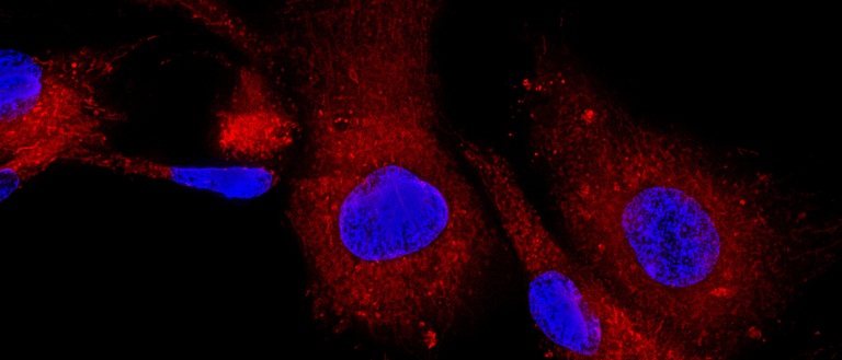 A Japanese Man Has Become the First Recipient of Donated, Reprogrammed Stem Cells