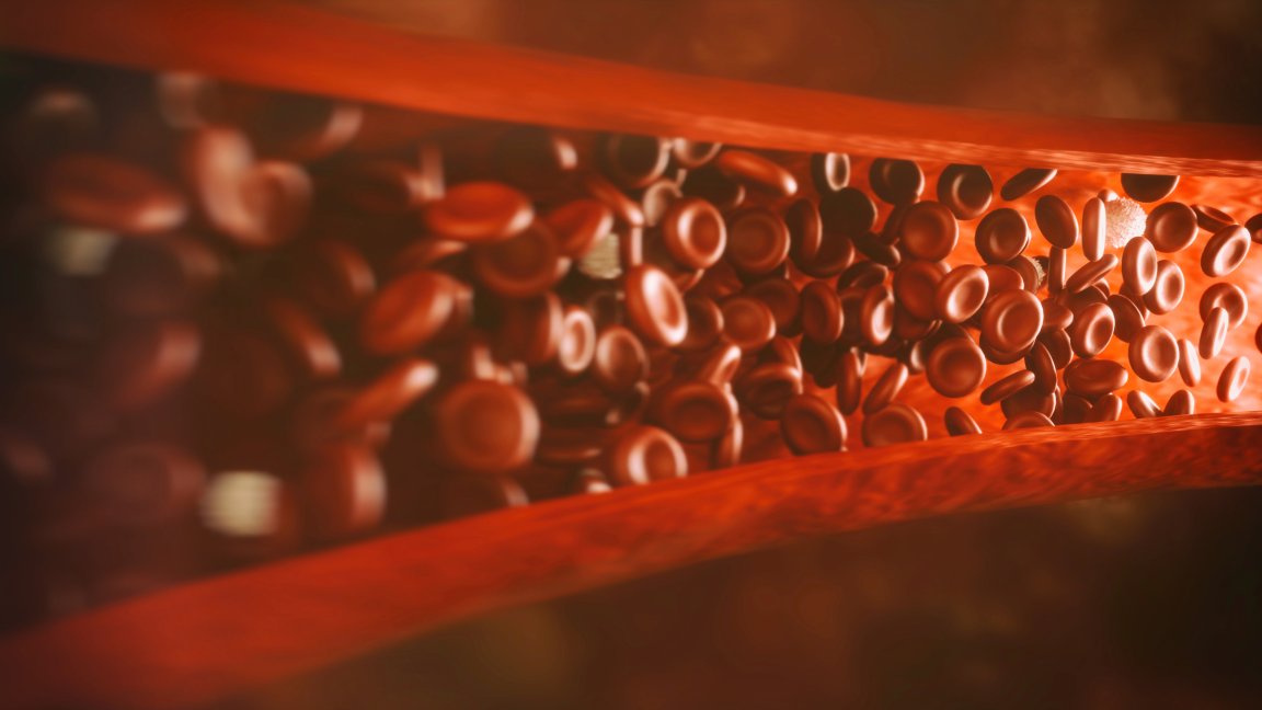 3d printing printing vascular disease medicine children child health