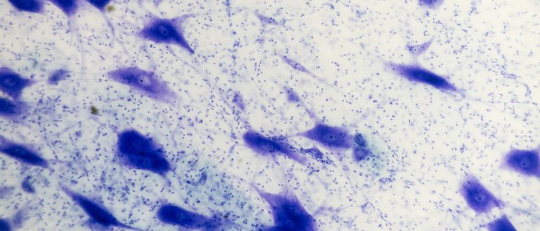 Your Brain Cells Could Be Reprogrammed to Fight Parkinson’s Disease