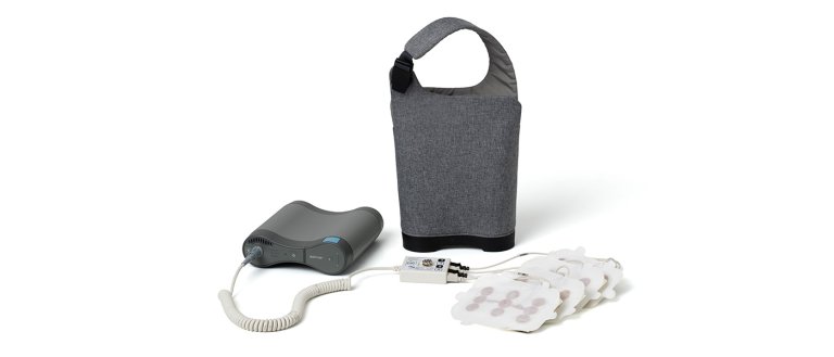 optune novocure glioblastoma brain cancer electric cap