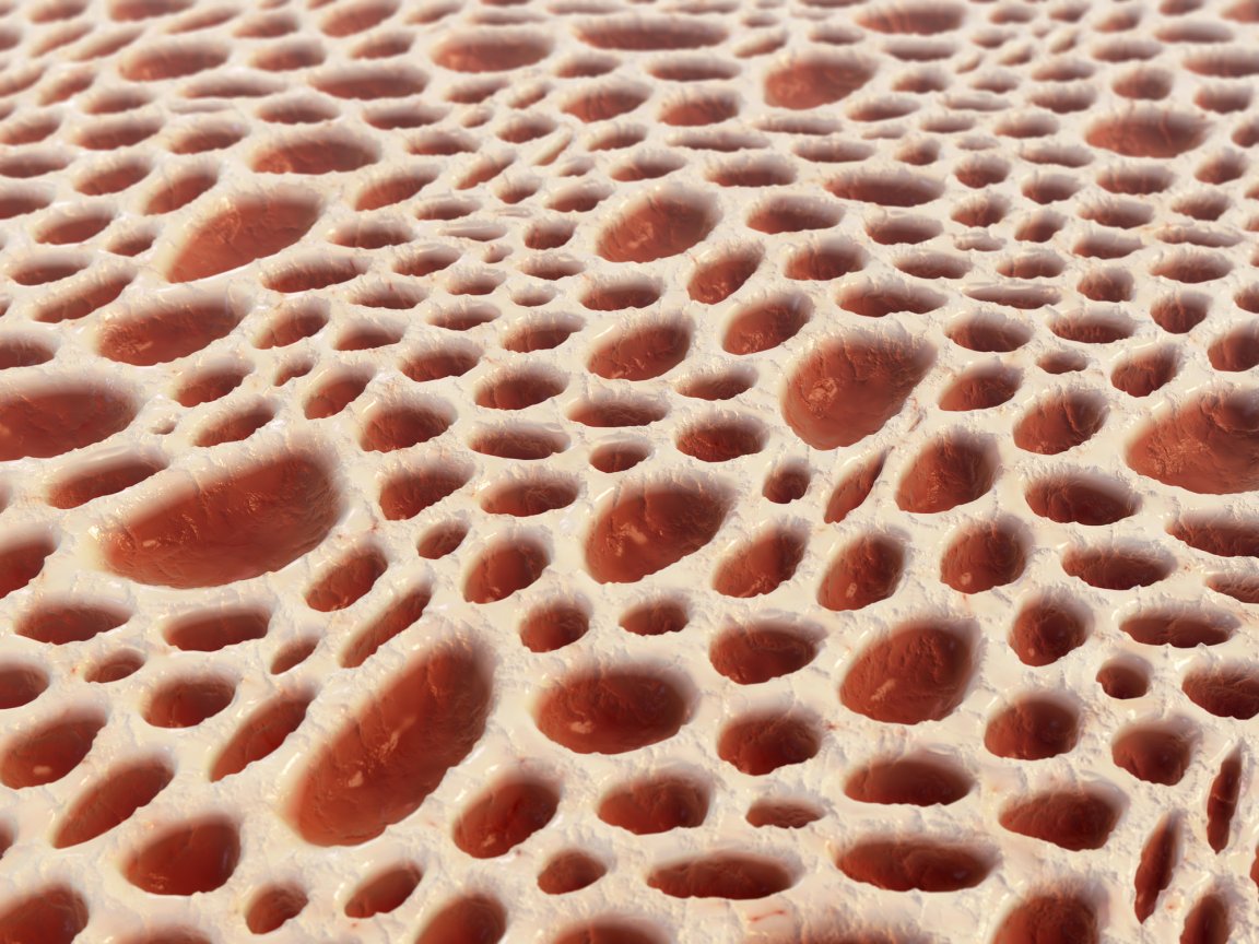 bone marrow medical implants blood disorders