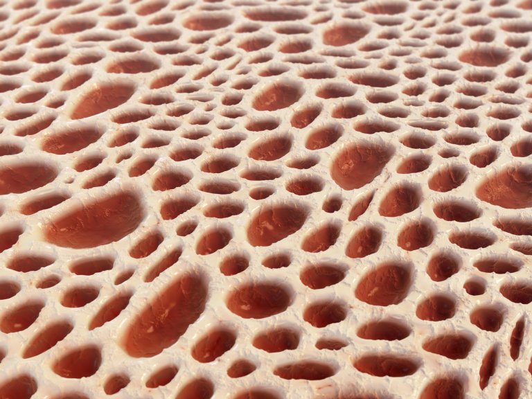bone marrow medical implants blood disorders