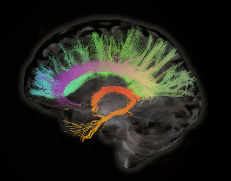 Harvard Neuroscientist: Meditation Reduces Stress and Literally Changes Your Brain