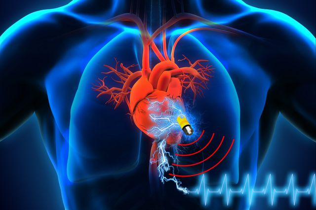 [Taken] New Implantable Medical Device Is Powered By the Human Body