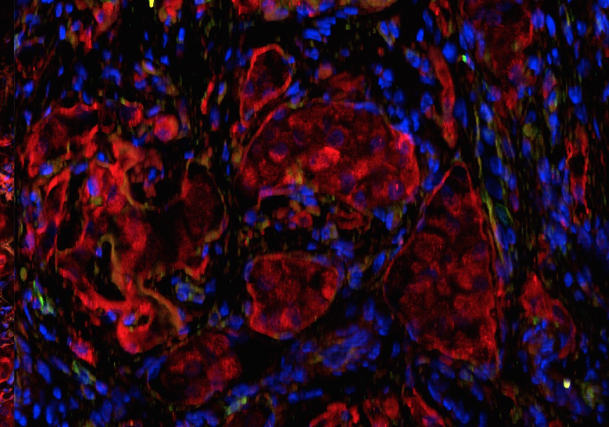 Image credit: Diabetes Research Institute/University of Miami Miller School of Medicine
