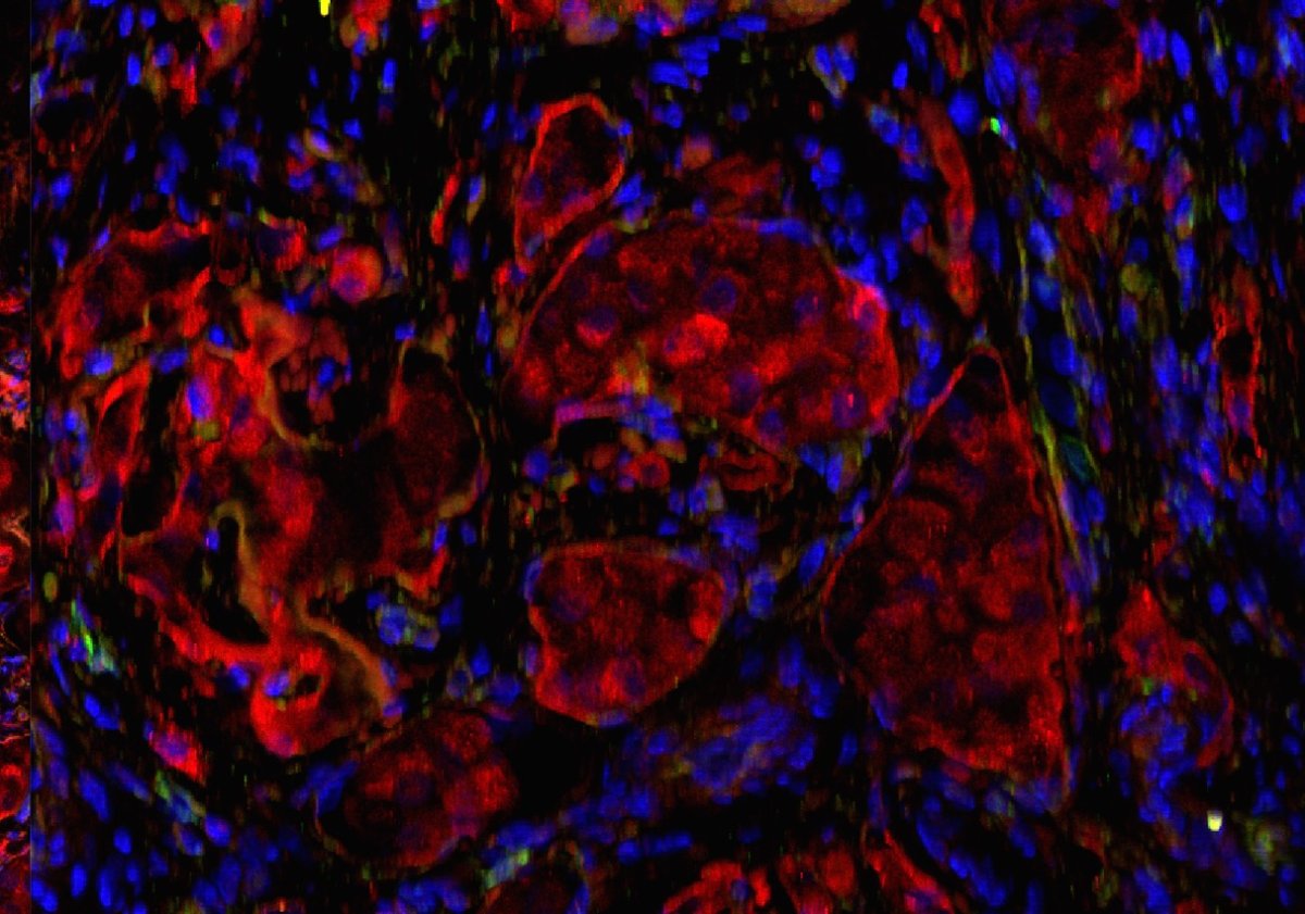 Image credit: Diabetes Research Institute/University of Miami Miller School of Medicine