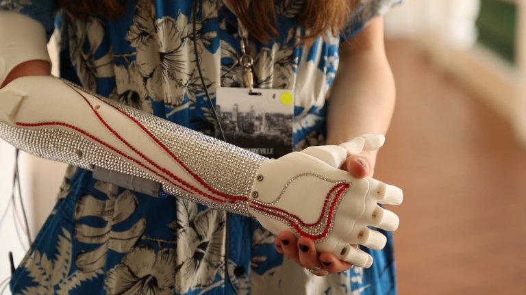 A New 3D Printed Bionic Hand Could Help Two Million Worldwide