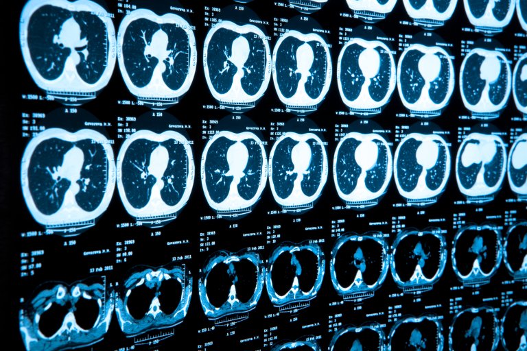 An AI Can Now Predict How Much Longer You’ll Live