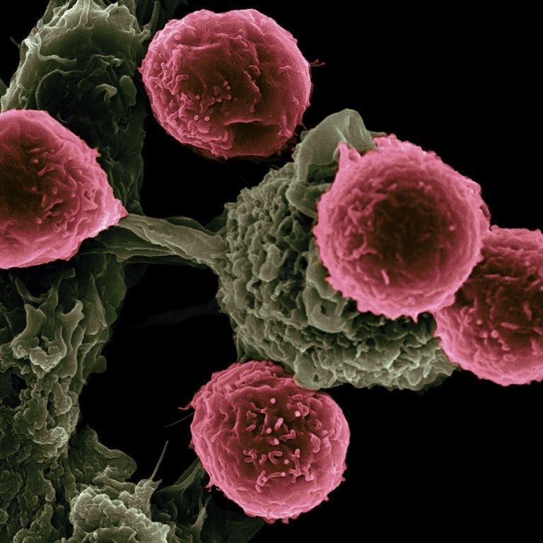 An FDA Panel Just Approved A Treatment That Genetically Alters Your Own Cells