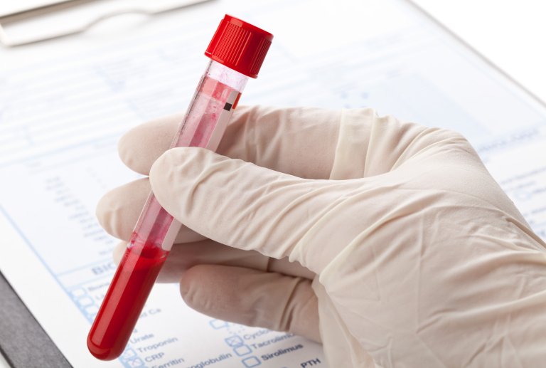 alzheimer's disease blood test lifestyle interventions