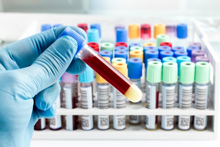 cancer research diagnosis blood test mirna