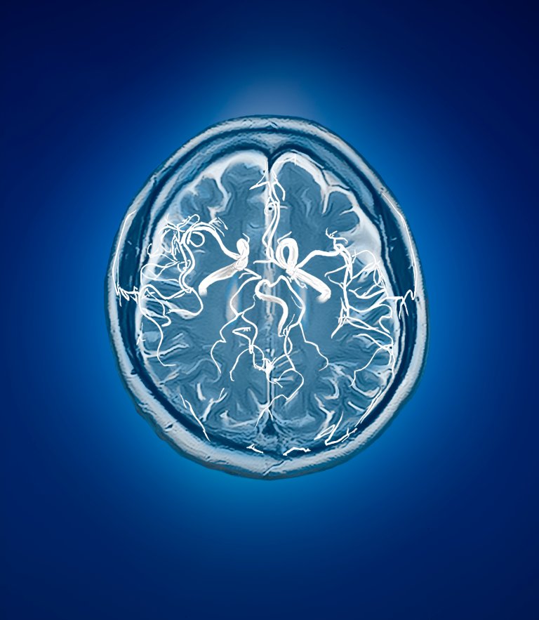 New Study Reveals a Group of Neurons Active in Anxious Brains