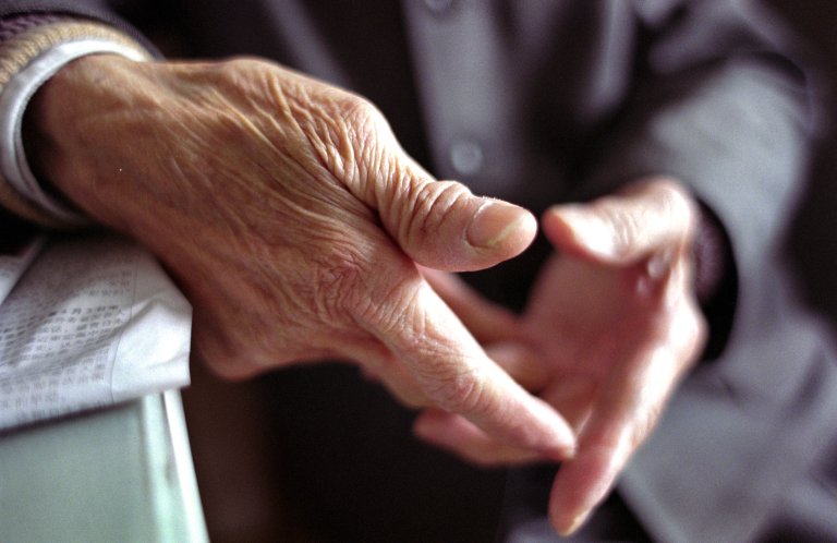 anti-aging progeria cellular aging longevity