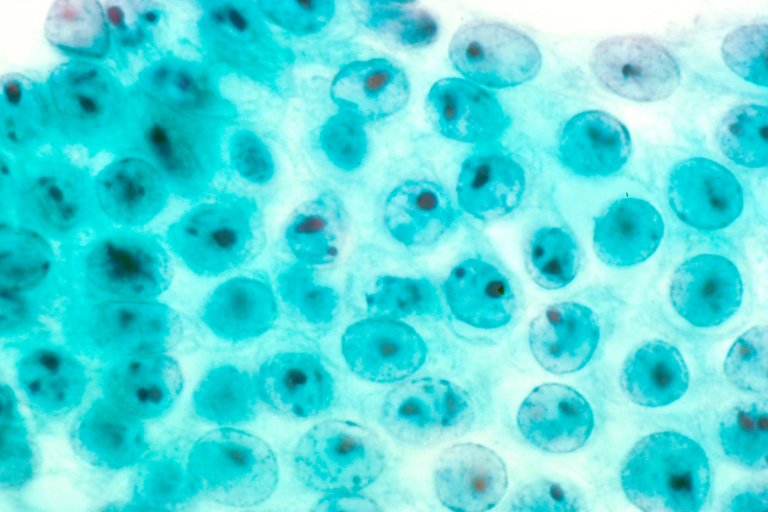 “Mini Organs” Could Change How We Treat Diseases from Cystic Fibrosis to Cancer