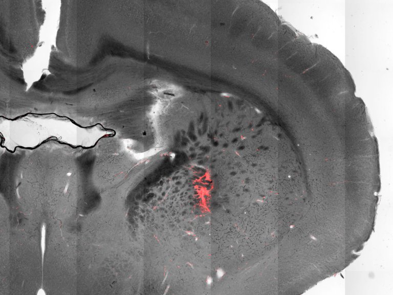 neurology magneto-thermal stimulation brain mice