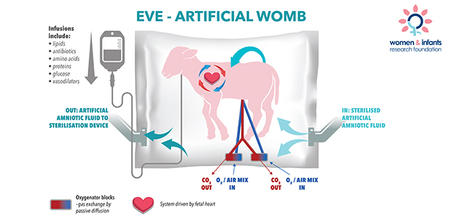 Image credit: Women & Infants Research Foundation