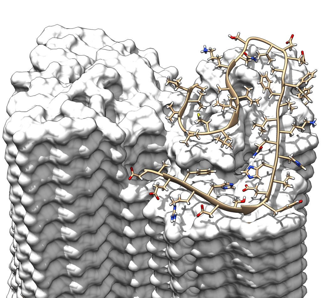 We Now Have a Detailed Model of the Protein Structure Linked to Alzheimer's