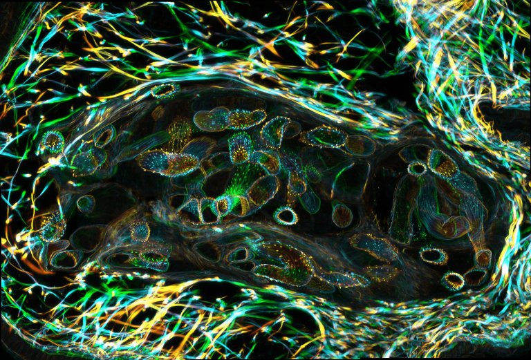 leishmaniasis sand fly climate change parasite microbe