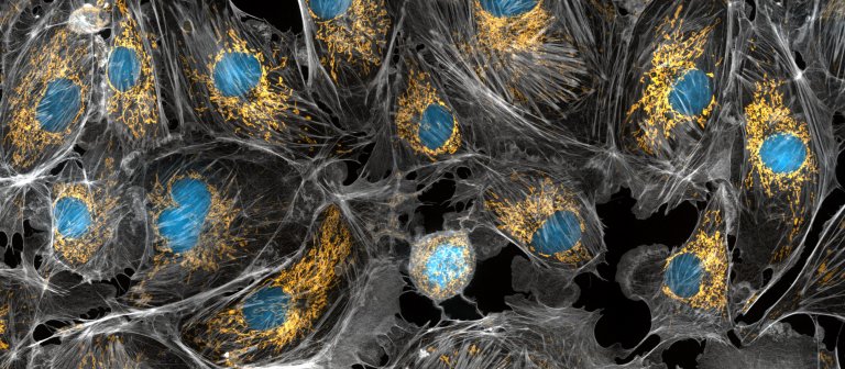 New Study Reveals How Mitochondria Are Affected by Disease
