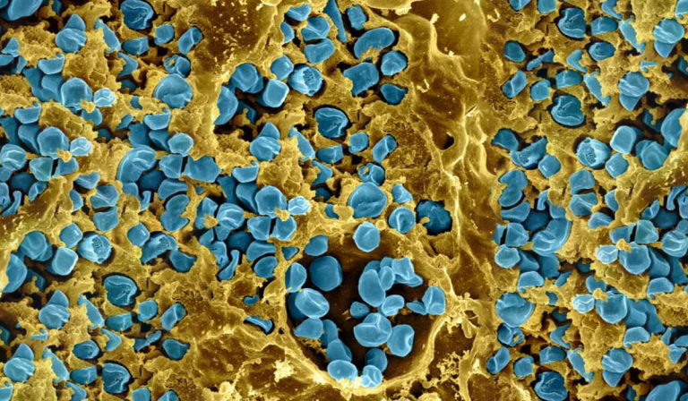 Scientists Have Found a Way to Disable a Potentially Deadly Bioweapon