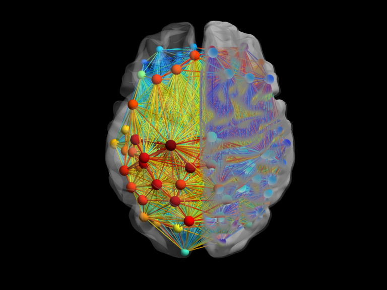 transcranial magnetic stimulation schizophrenia