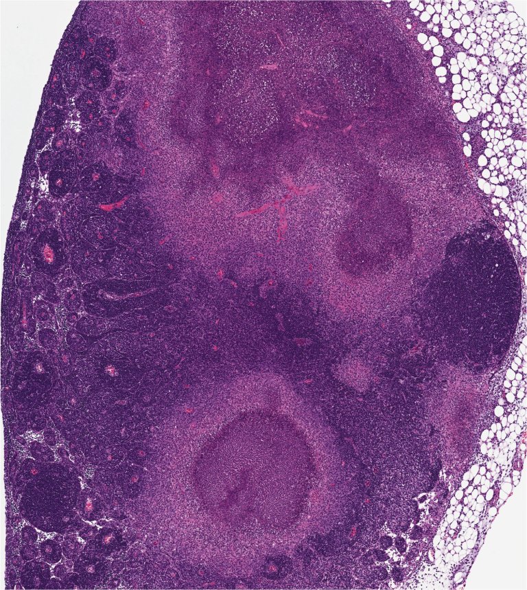 Dying Cells Can Warn Their Neighbors in an Attempt to Stave Off Infection