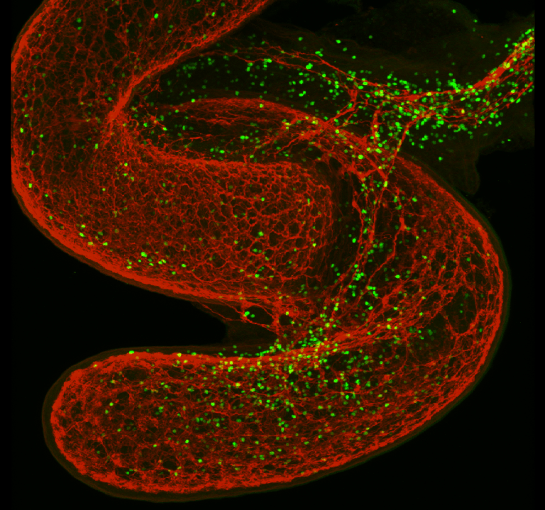 Neurons Use a Type Of “Adrenaline Rush” to Communicate With the Immune System