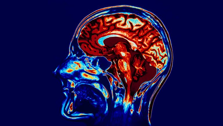 Researchers Restore Consciousness in Man After 15 Years in a Vegetative State