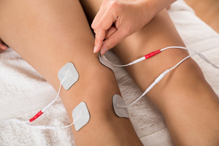 Electrical Stimulation Can Effectively Restore Movement in Paralyzed Limbs