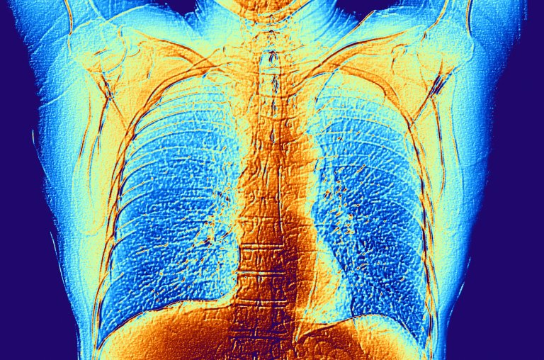 Researchers Have Created a New Camera Capable of Seeing Through the Human Body