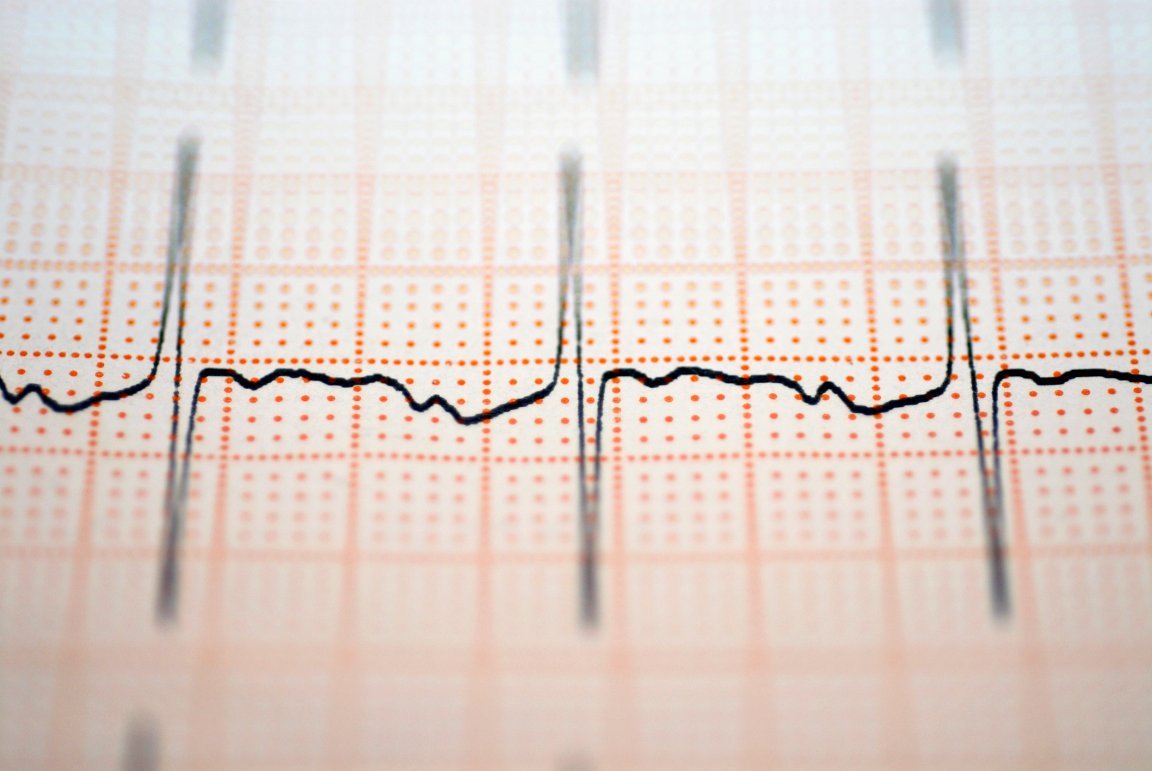 security biometrics heart computer security