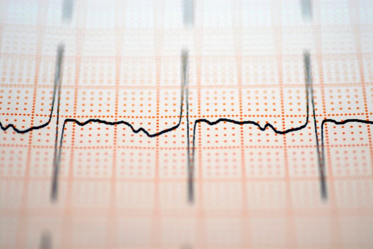 security biometrics heart computer security