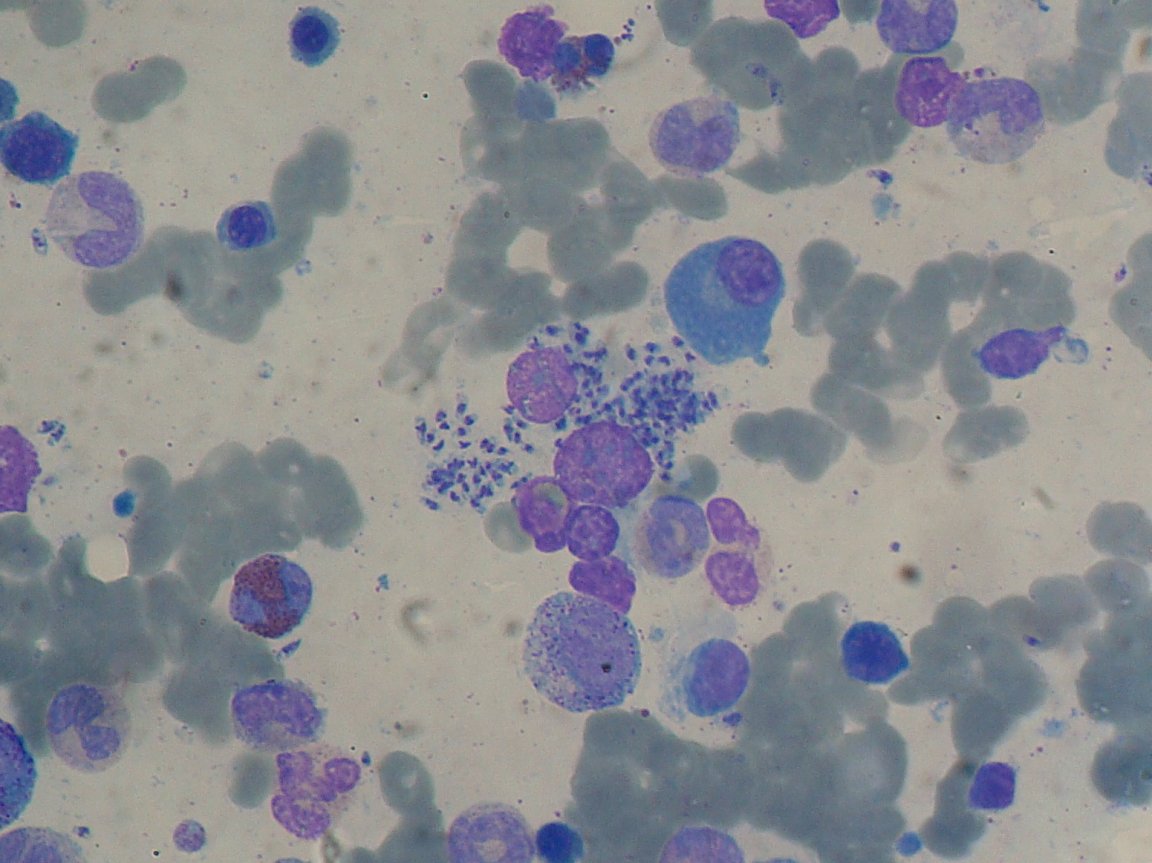 leishmania leishmaniasis climate change vaccine