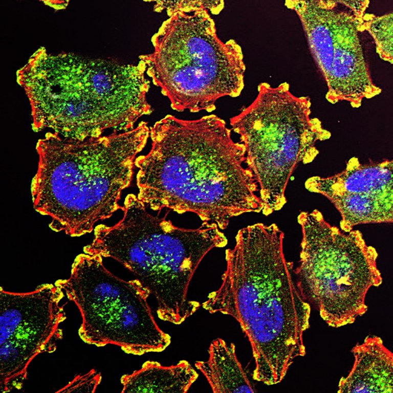 Researchers Find “Executioner Protein” That Causes Cancer Cells to Self-Destruct Without Hurting Healthy Cells