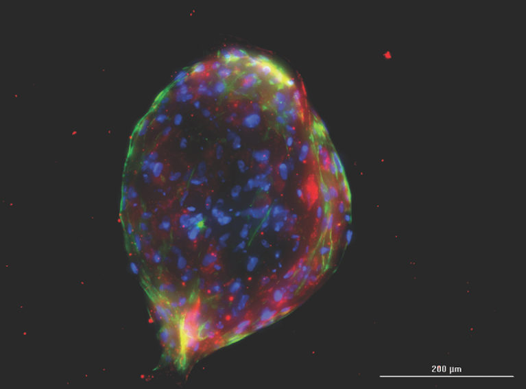 FDA Approves New Clinical Trial Using Stem Cells to Treat Non-Healing Wounds