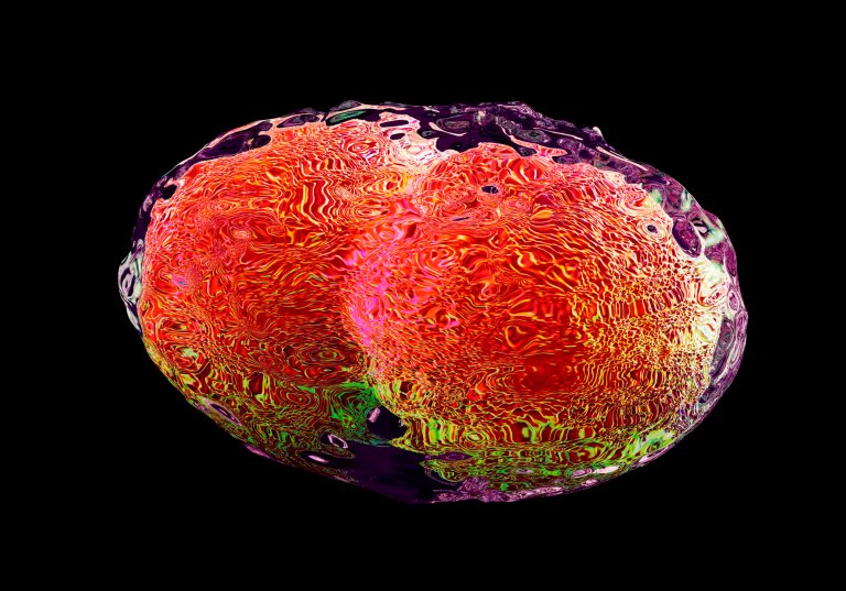 Scientists Eradicated Smallpox. With Synthetic Biology, We Can Bring it Back.
