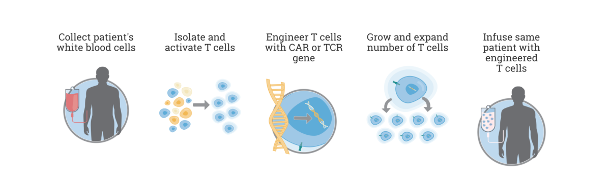 Yescarta, a gene-altering cancer treatment, is made from re-engineered T cells which then encourage the body to fight off its cancer.