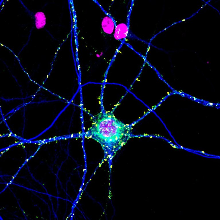 In First-Ever Demonstration, Researchers Show Ultrafast Light Pulses Can Trigger Neurons to Fire