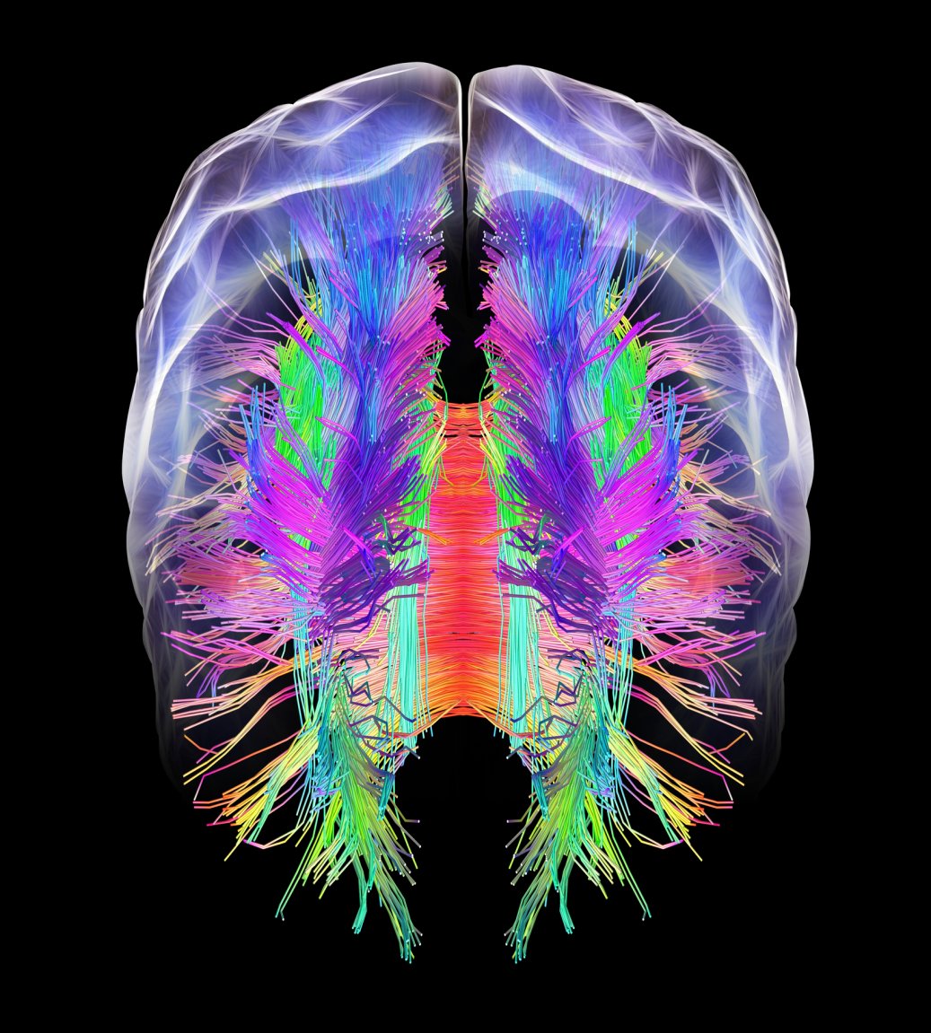 whole-brain map