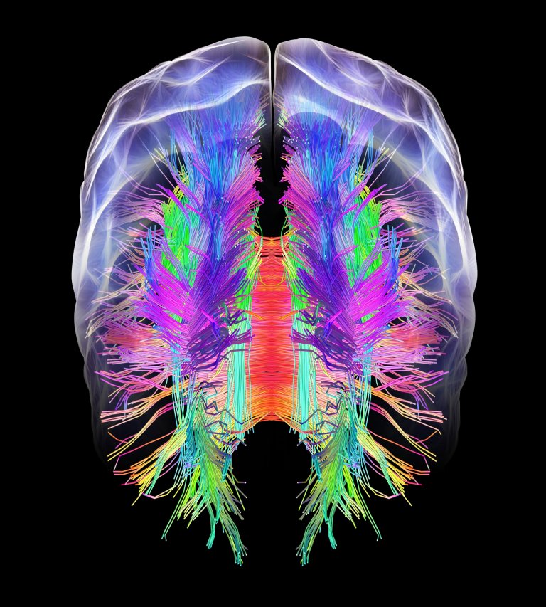 whole-brain map
