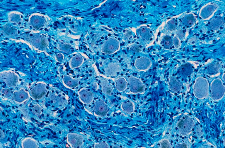 Groundbreaking New Work “Rejuvenates” Old Cells
