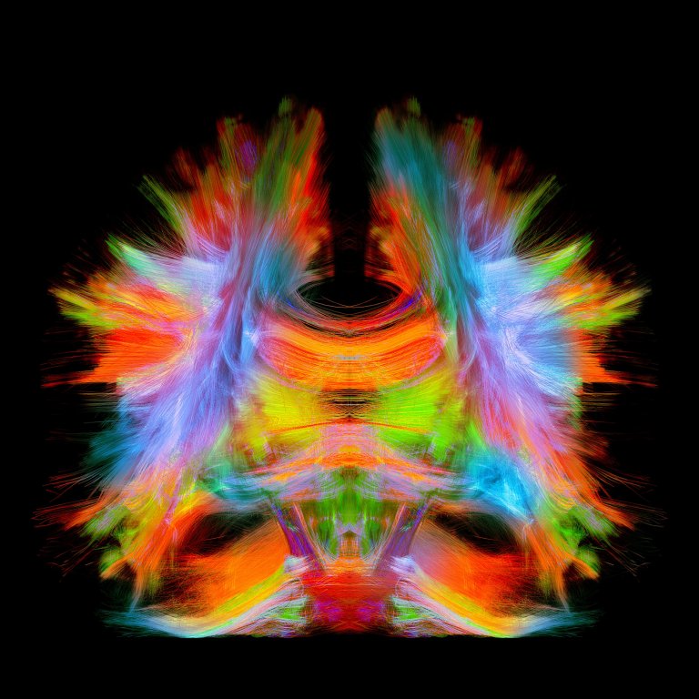 Sight Unseen: Advanced Imaging Will Solve the Greatest Mysteries of the Human Body