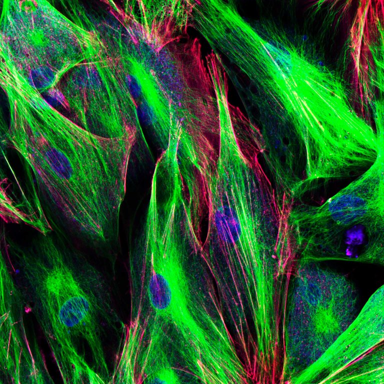 A Key Evolutionary Step May Mean Intelligent Alien Life Doesn’t Exist in the Universe