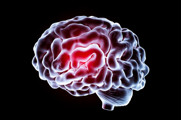 For the First Time Ever, Scientists Boosted Human Memory With a Brain Implant