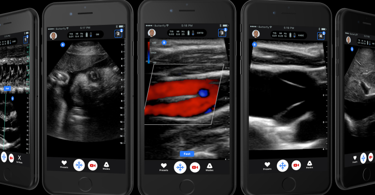 A New Device Lets You Conduct an Ultrasound With a Smartphone