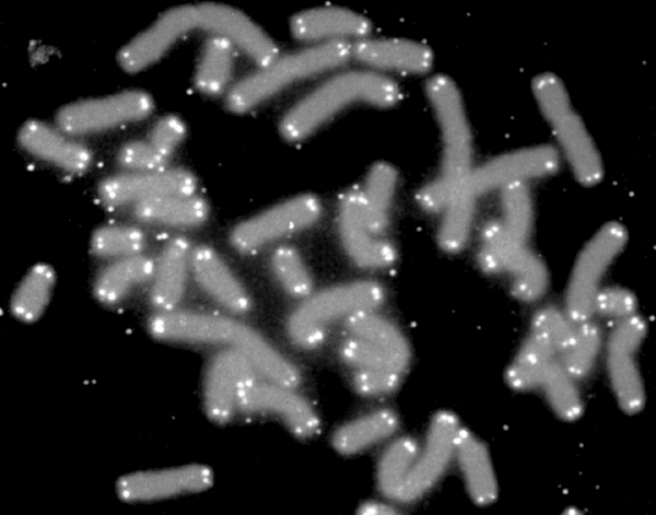 Human chromosomes, in grey, topped by protective telomeres in white. (Image credit: U.S. Department of Energy Human Genome Program)